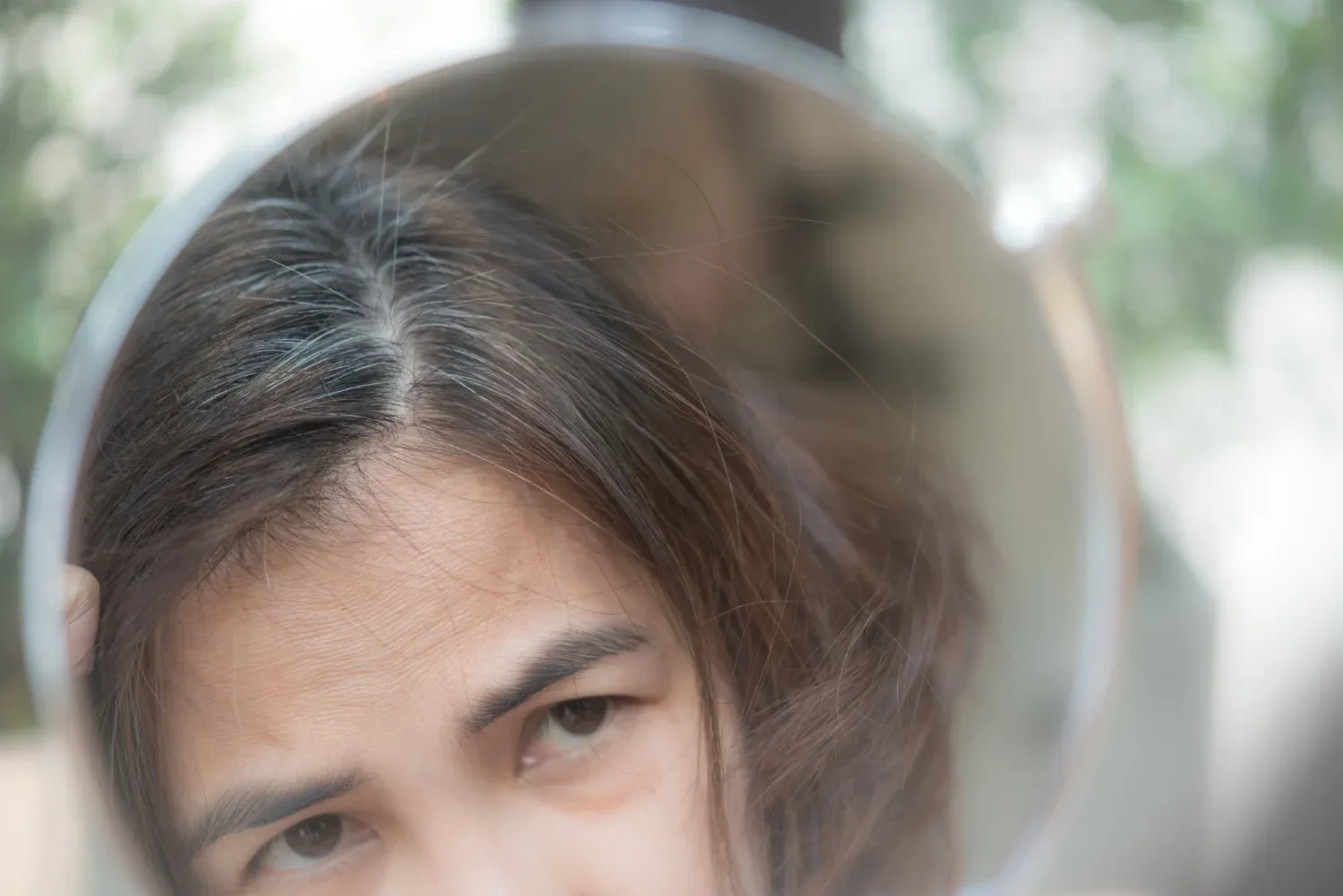 Managing Menopausal Hair Loss Insights and Solutions for Healthier